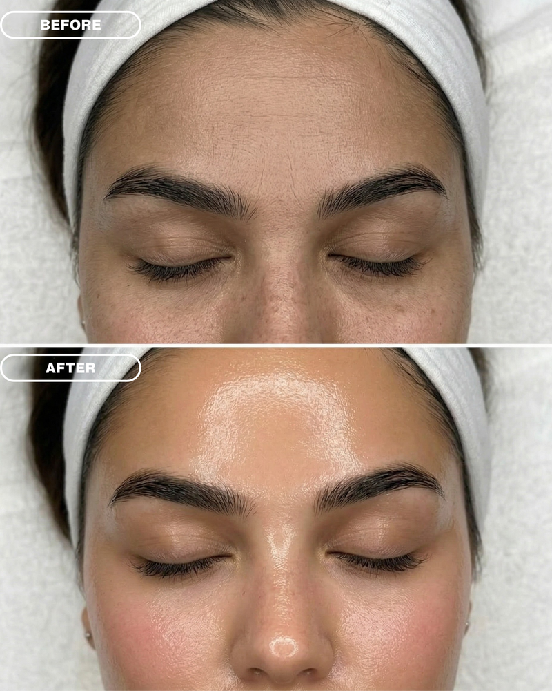 Red Carpet Hydrafacial