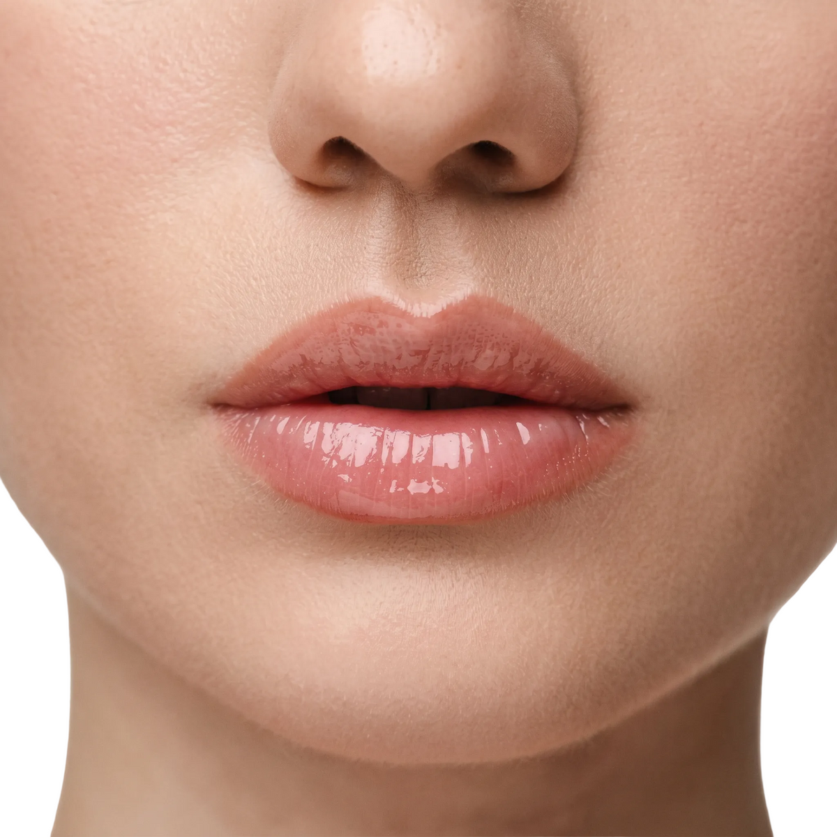 Lip Filler 1.5ml