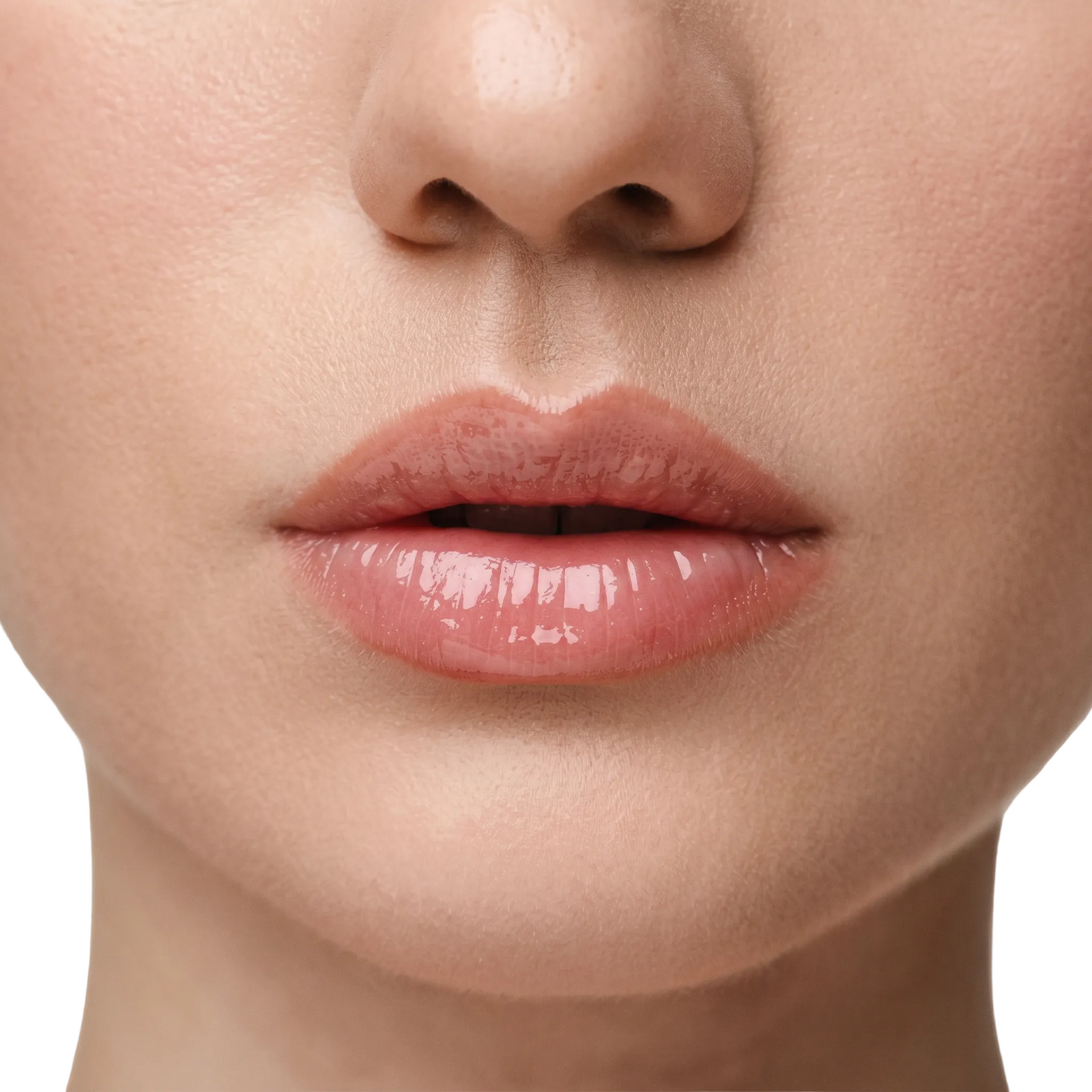 Lip Filler 1.5ml