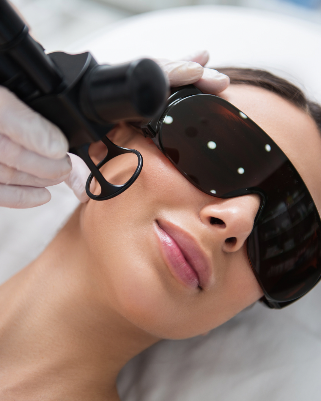CO2 Laser Full Face